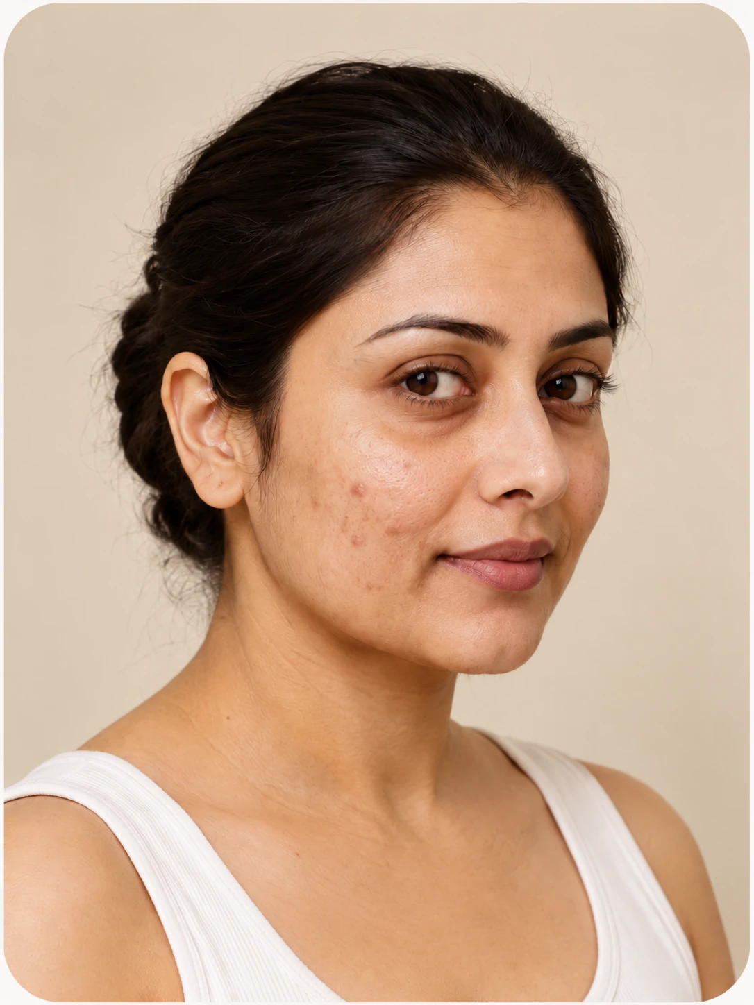Dermatology Consultation, illustrative after example