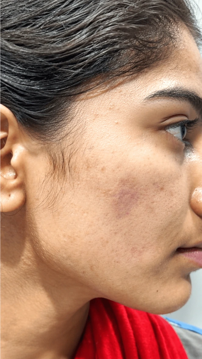 Exoluxe Medi-Facial, illustrative after example