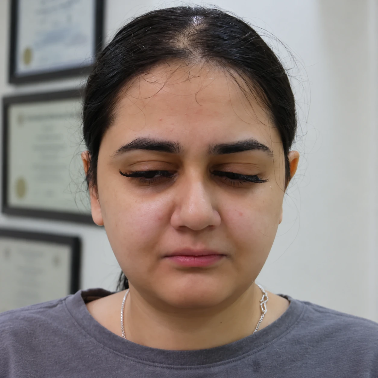 Medi-Facials, illustrative before example