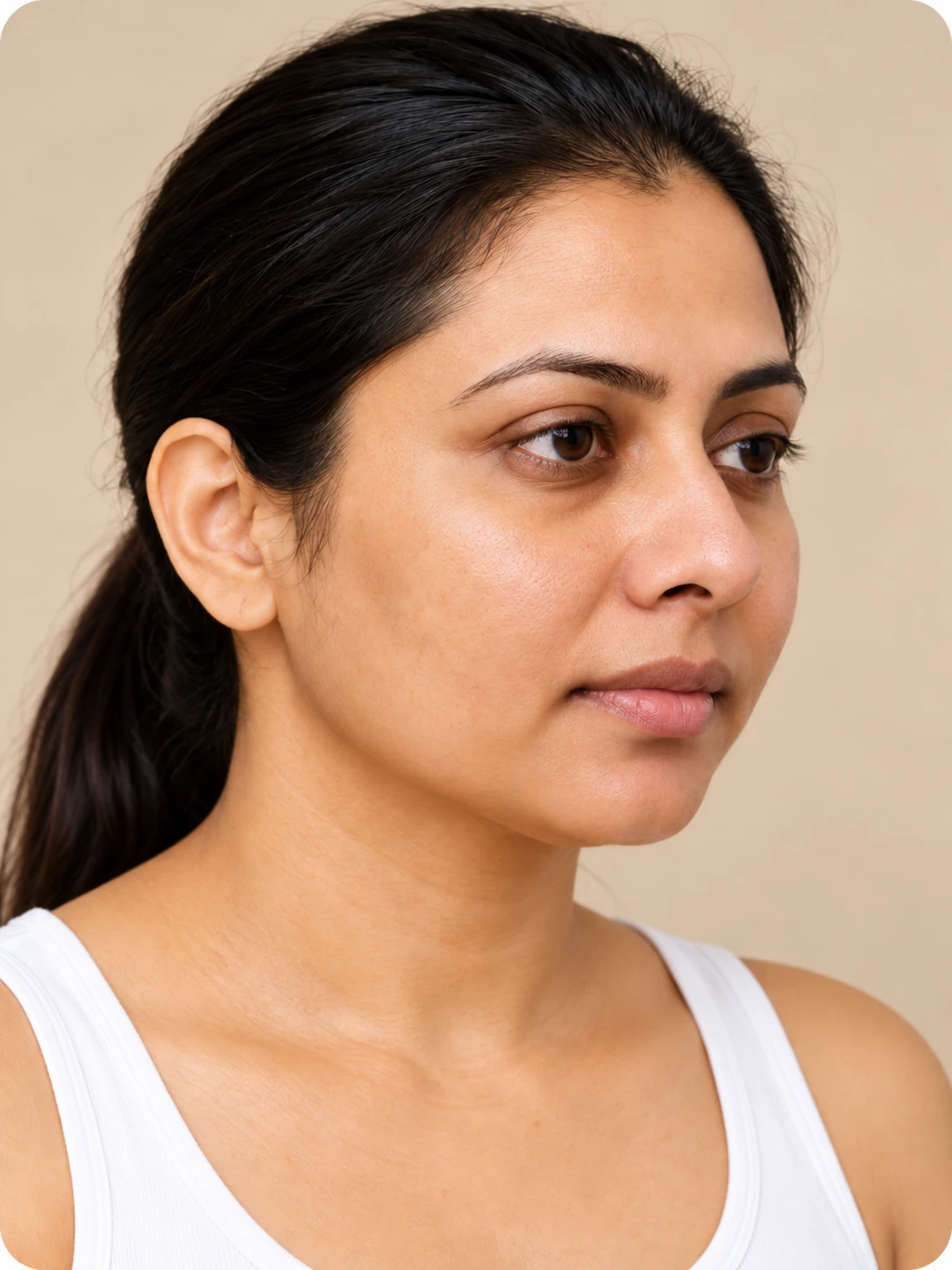 Microdermabrasion, illustrative after example