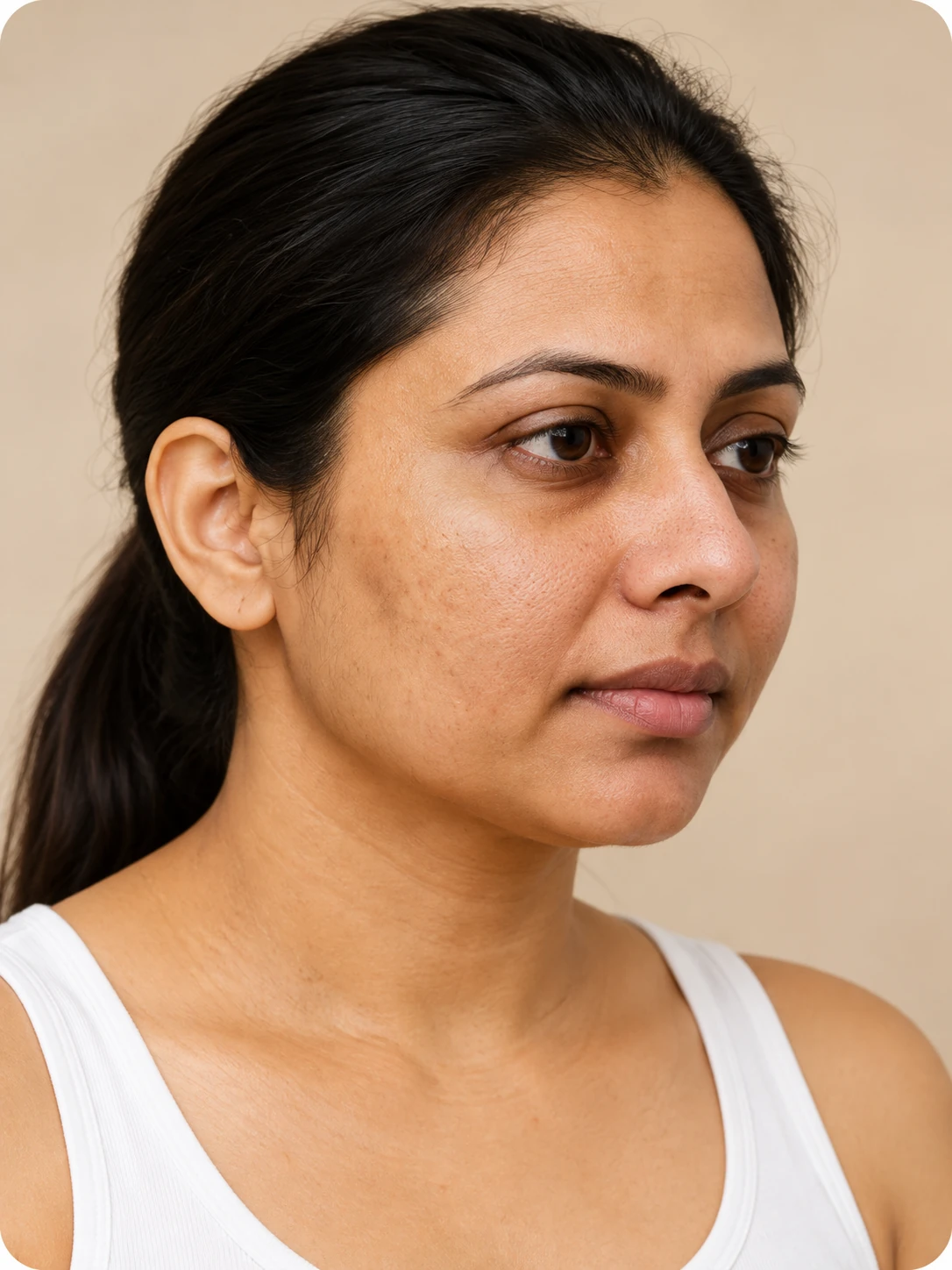 Microdermabrasion, illustrative before example